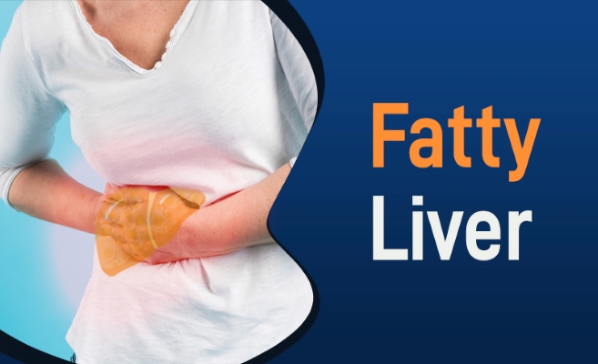 Fatty-Liver