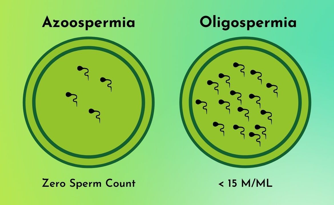 azoospermia